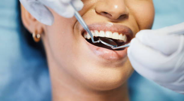 Best Emergency Tooth Extraction  in East Palo Alto, CA